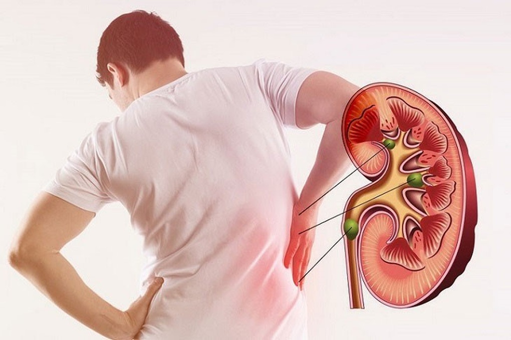 5 món càng dùng nhiều, thận càng nhanh hỏng