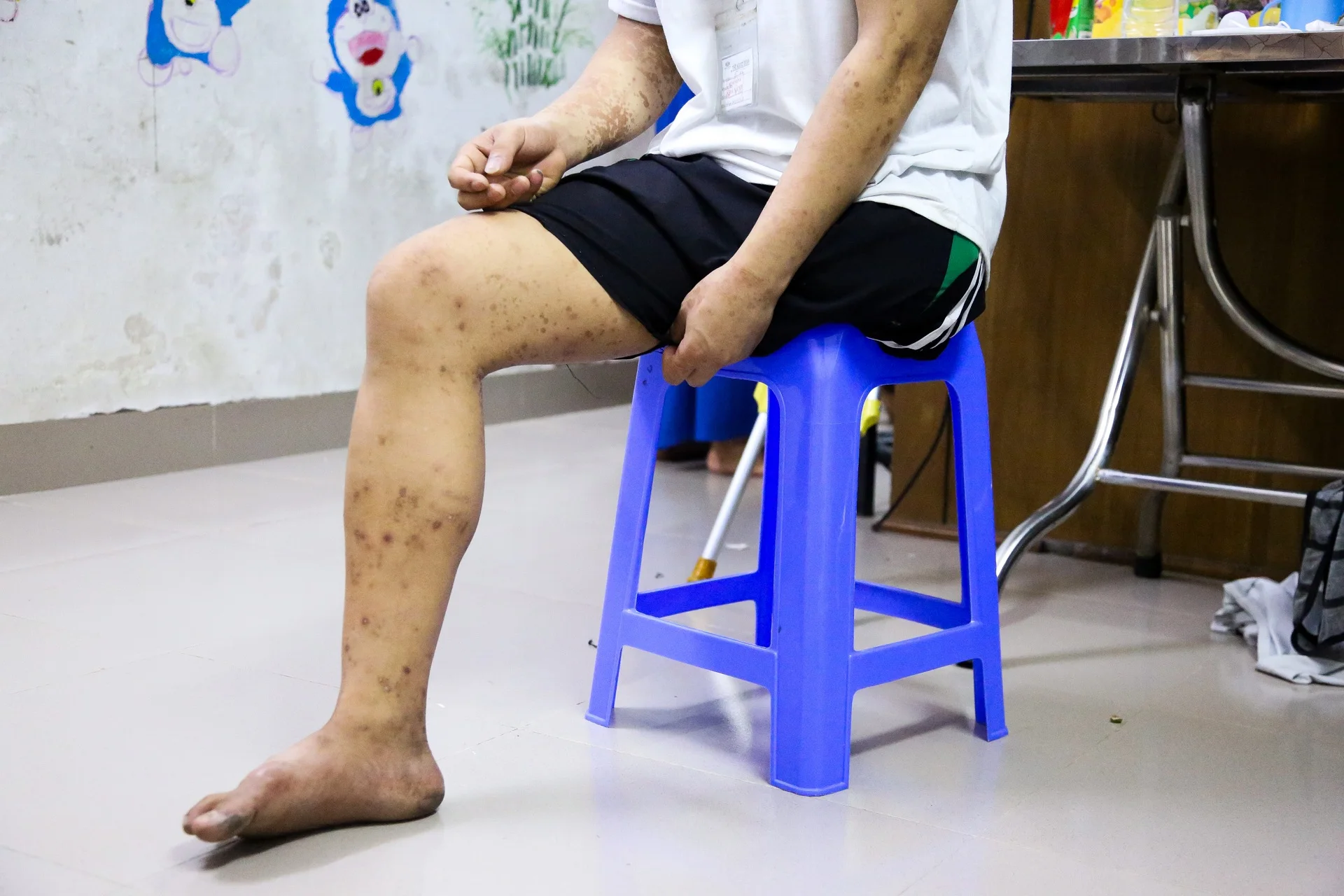 Những gia đình cùng kiệt vì viện phí, mẹ bán nhà đổi vài năm sống cho con - 7 Những gia đình cùng kiệt vì viện phí, mẹ bán nhà đổi vài năm sống cho con - 7