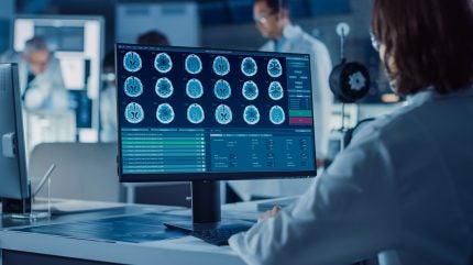 Northwestern Medicine’s AI radiology tool shows enhanced productivity