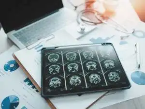 dementia risk for menopausal women