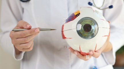 Outlook’s wet AMD treatment accepted by SMC for NHS Scotland