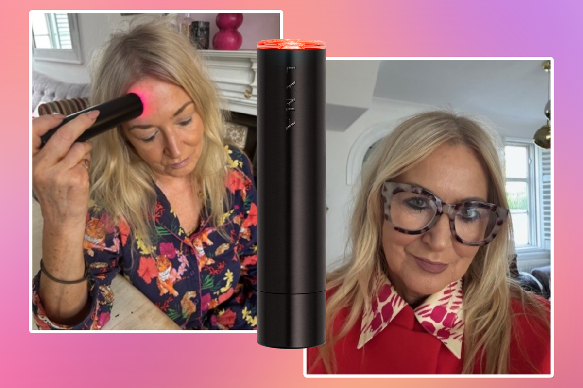 I tried Lyma’s laser that claims to ‘make skin look younger’