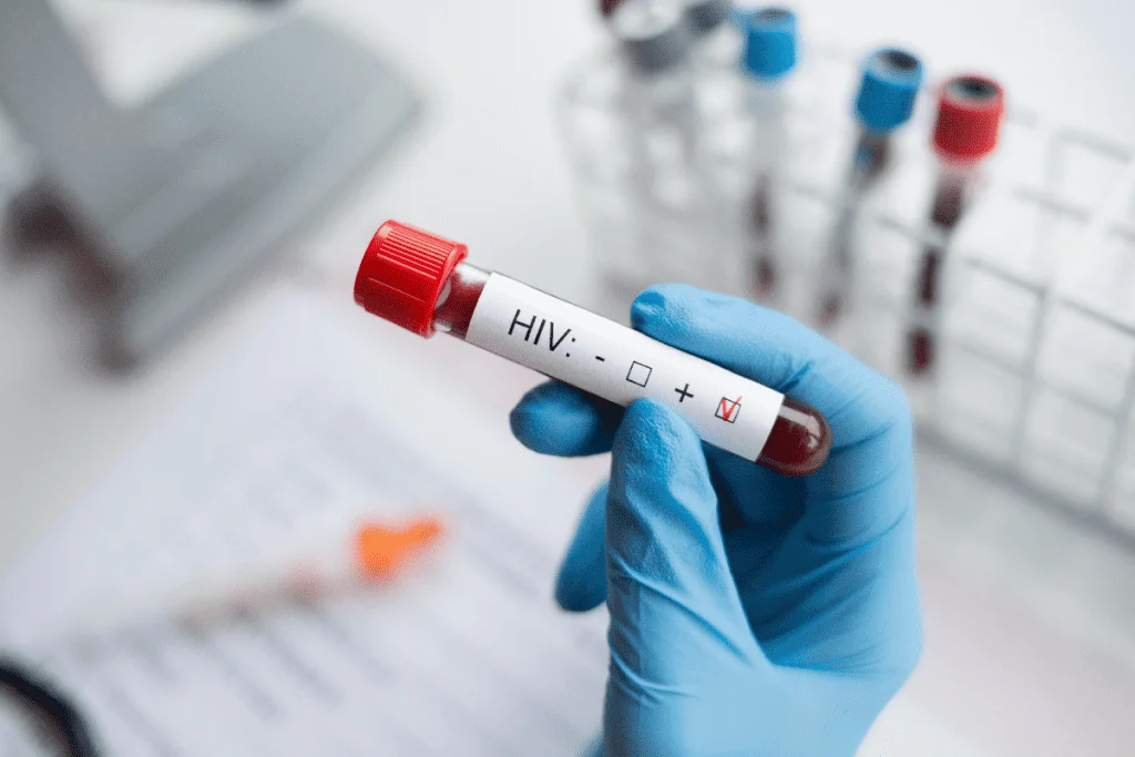 imagem mostra um tubo com sangue infectado pelo vírus hiv