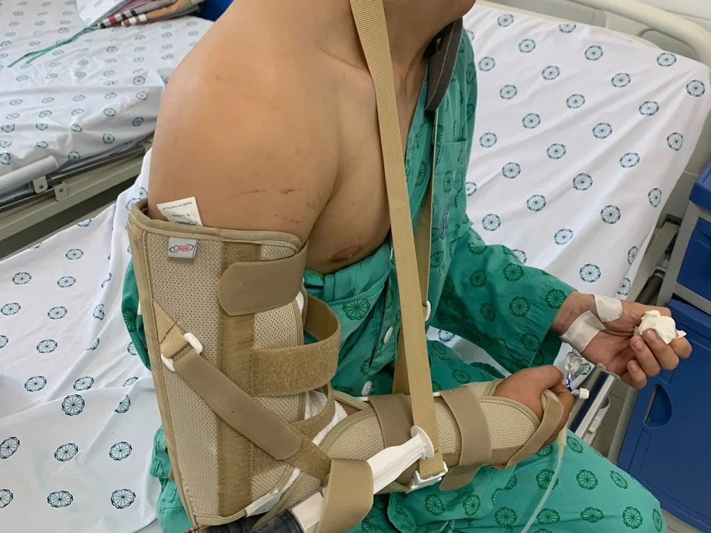 Chơi vật tay, chàng trai Hà Nội gãy xương - 2 Chơi vật tay, chàng trai Hà Nội gãy xương - 2