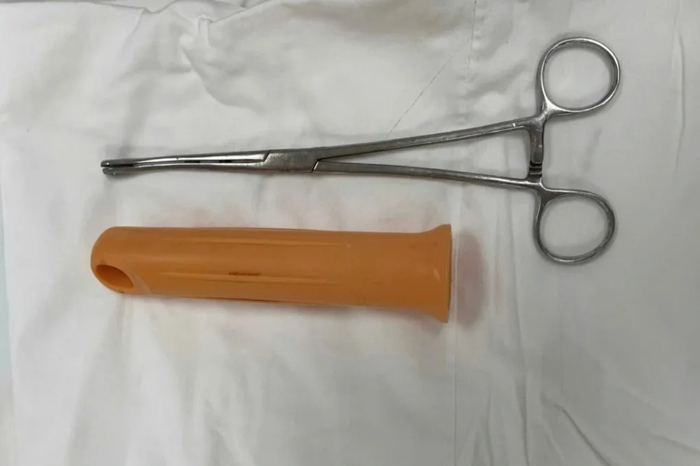 Nam thanh niên bị mắc kẹt cán cây lau nhà 15cm trong hậu môn - 2