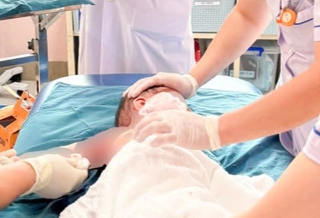 Hà Nội: 3 trẻ trong một gia đình bị bỏng do lật nồi lẩu