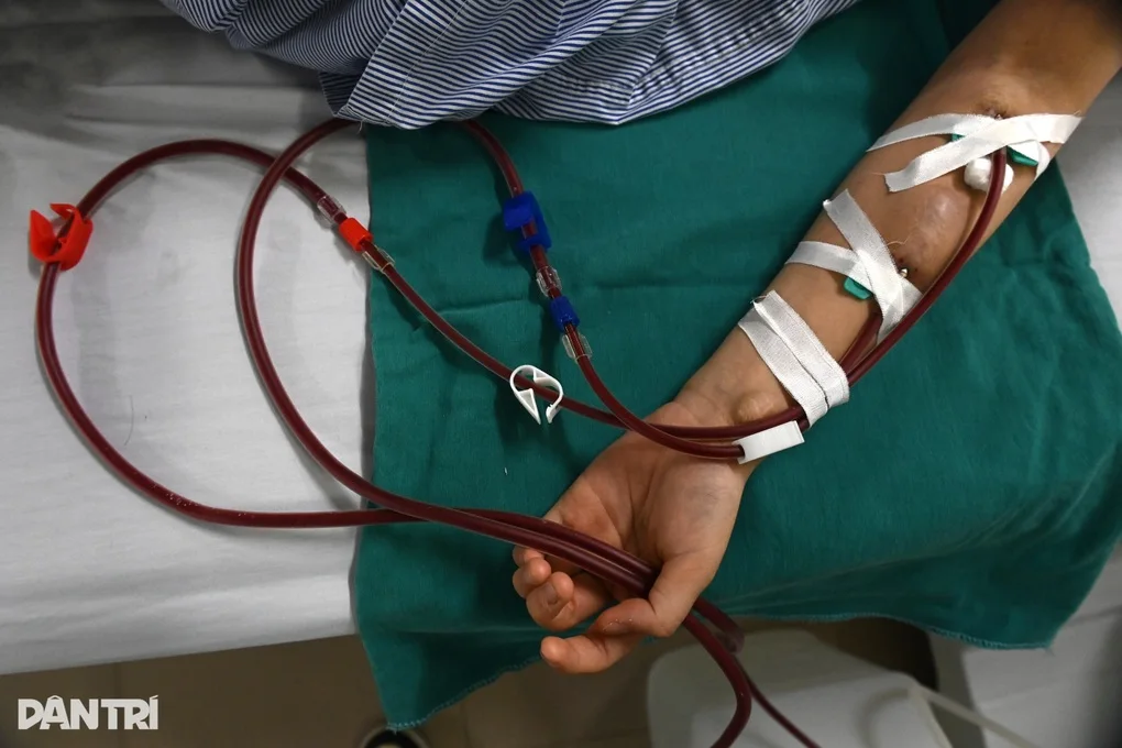 Bệnh thận mạn: Bom nổ chậm xóa mờ tương lai người trẻ, cả gia đình sống mòn - 2