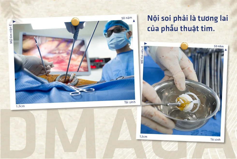50 năm đi tìm vết mổ 1,5cm tái sinh hàng nghìn trẻ em mang “án tử” - 15