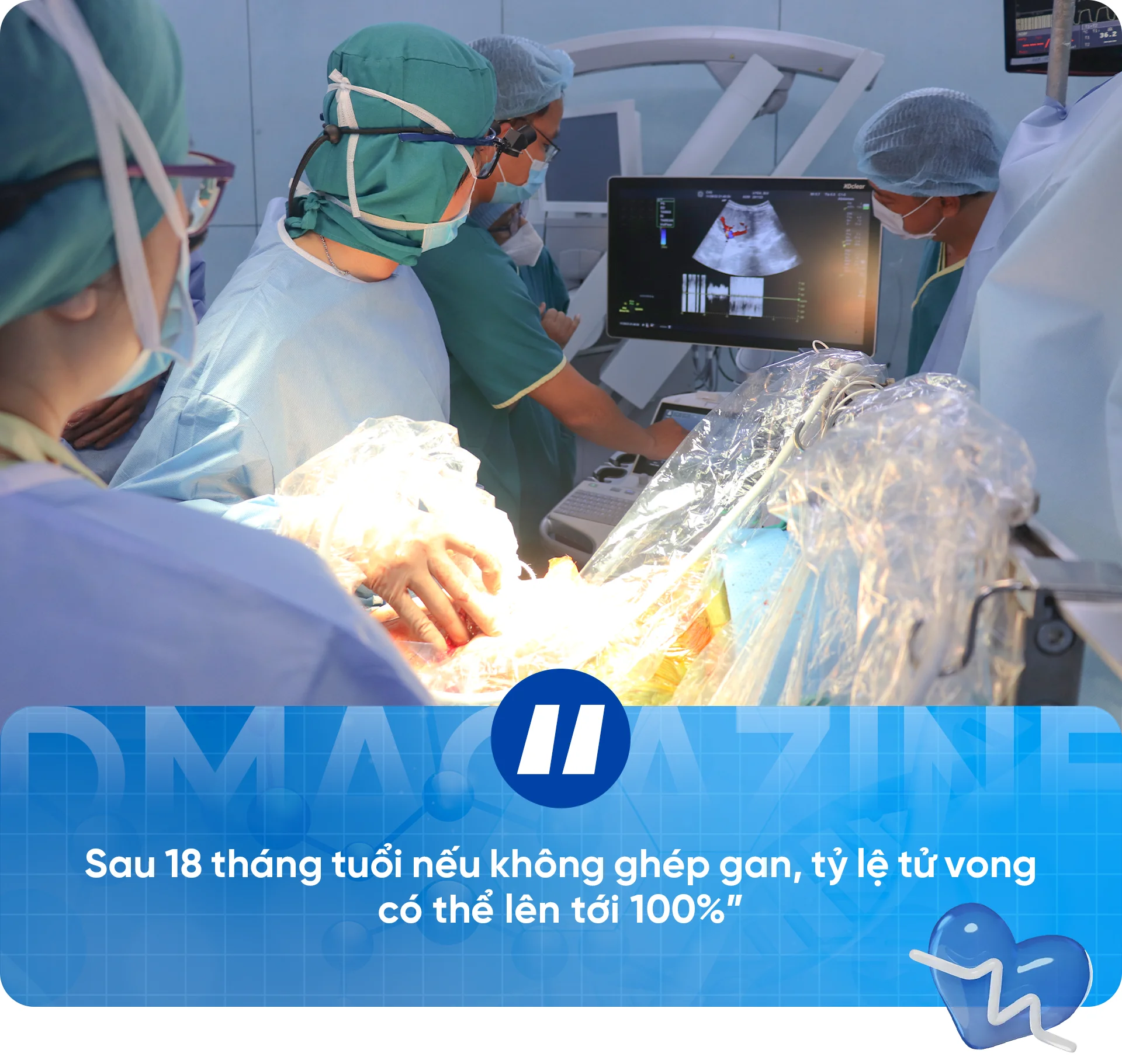 Hơn hai thập kỷ ghép tạng trẻ em: Viết tiếp những trang tuổi thơ dang dở - 3 Hơn hai thập kỷ ghép tạng trẻ em: Viết tiếp những trang tuổi thơ dang dở - 3