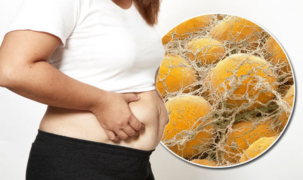 Làm thế nào để loại bỏ mỡ nội tạng nhanh chóng?