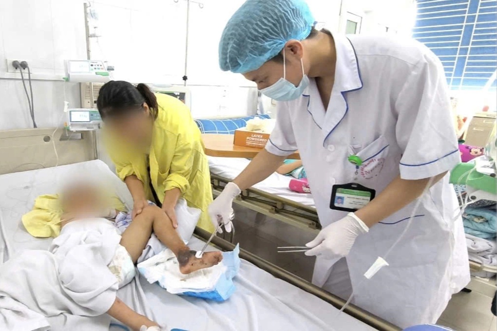 Bé trai hoại tử chân, suy hô hấp vì bị mèo cắn