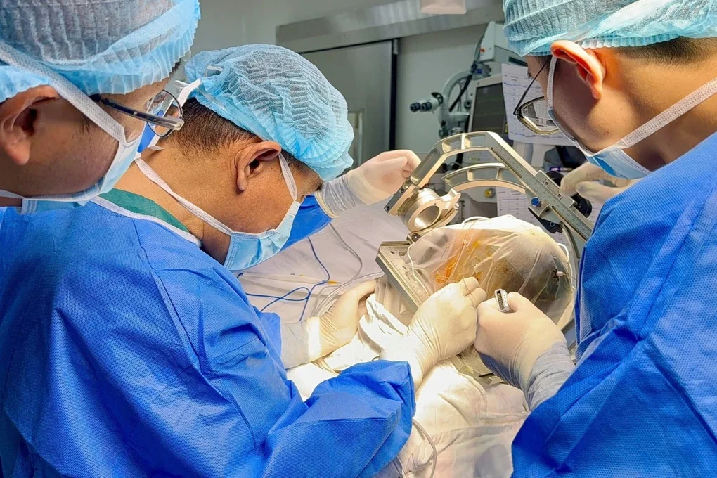 Thiếu nữ 16 tuổi thoát cơn động kinh nhờ kỹ thuật mới - 1