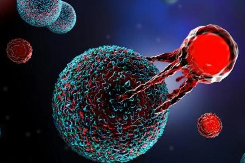 Bác sĩ bệnh viện tuyến cuối nói gì về liệu pháp CAR-T cell trị ung thư máu? - 3