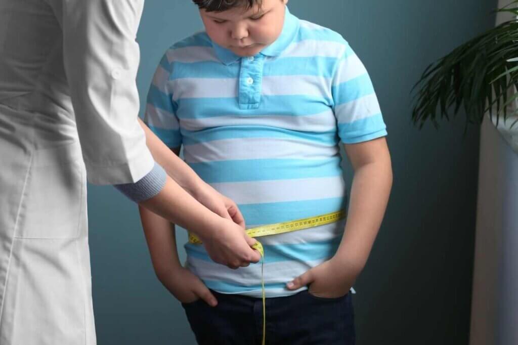 Obesity in Children