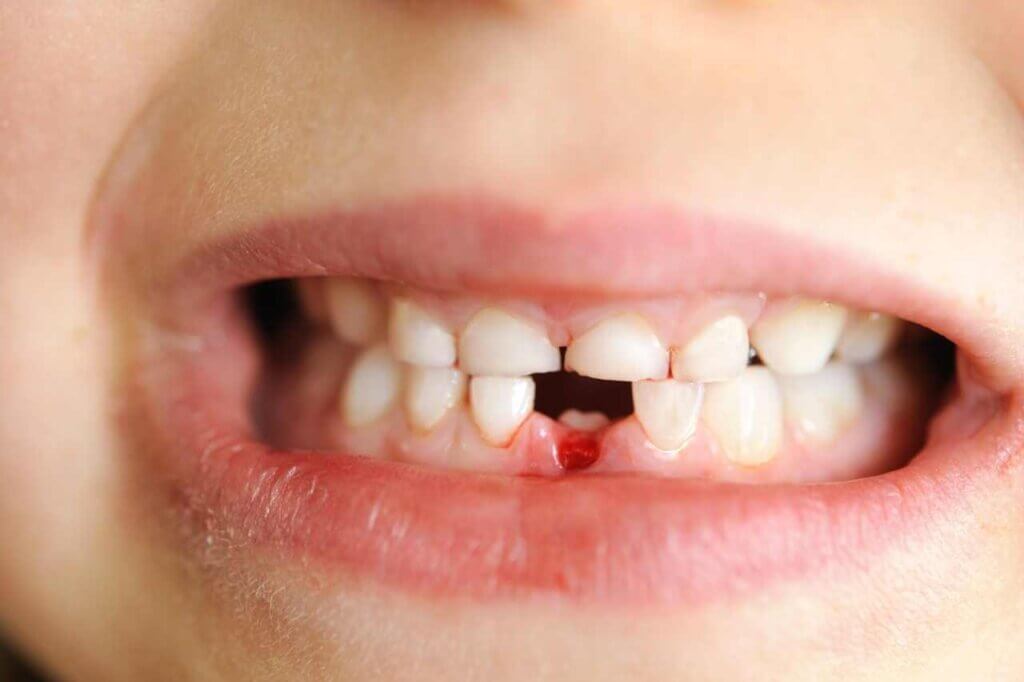Dentist Visits And The Loss Of Baby Teeth