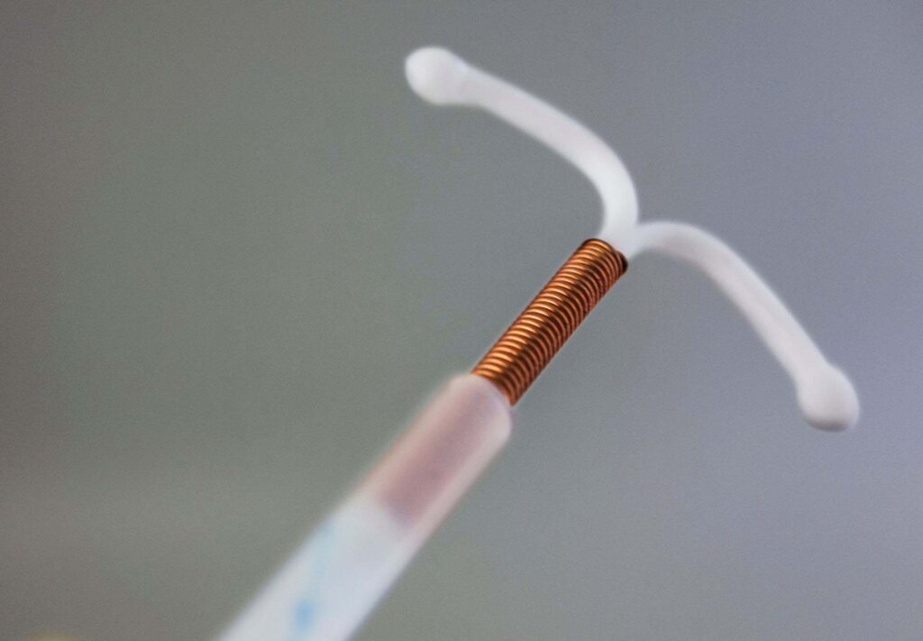 Pregnancy After IUD Removal