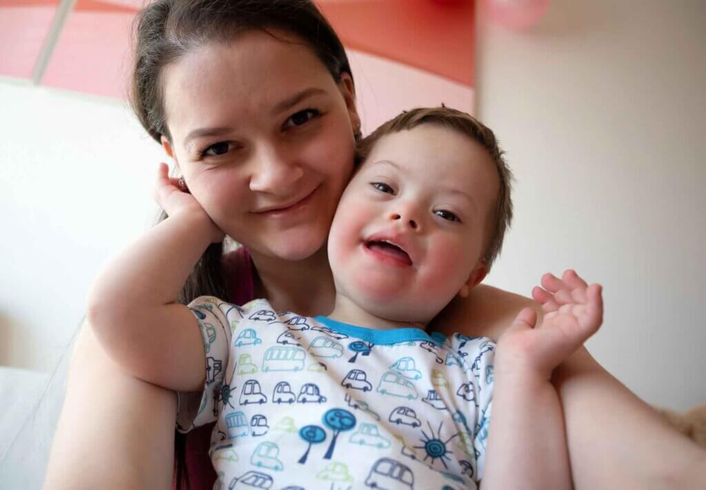 Down Syndrome Symptoms In Infants