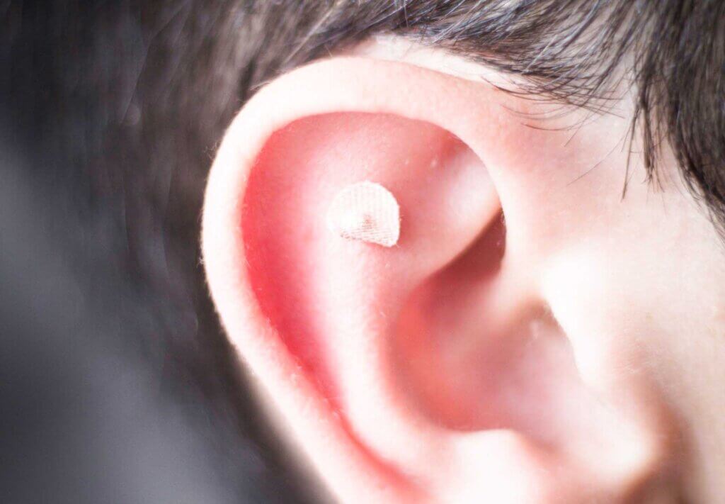 Everything Parents Should Know About Ear Seeds