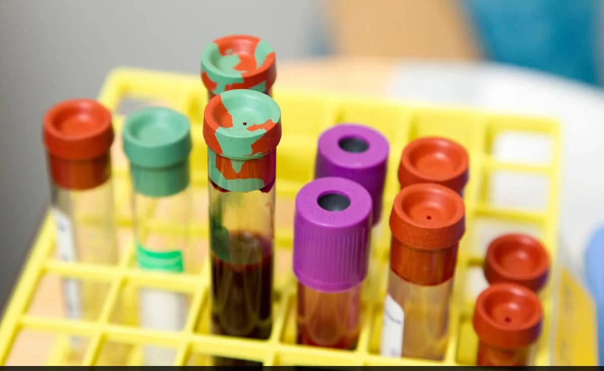 Woman Orders Clothes From Shein, Gets Vial Of Blood And Beans Instead Woman Orders Clothes From Shein, Gets Vial Of Blood And Beans Instead