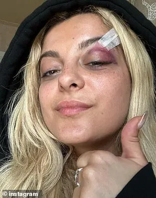 In last year's incident, Rexha received stitches after attendee Nicholas Malvagna pelted her with a cell phone at The Rooftop at Pier 17 during her Best F'n Night Of My Life tour